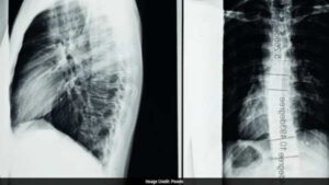 Chinese-Russian Medical Team Reportedly Performs First Spinal Cord Transplant in Moscow