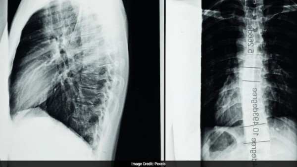 Chinese-Russian Medical Team Reportedly Performs First Spinal Cord Transplant in Moscow