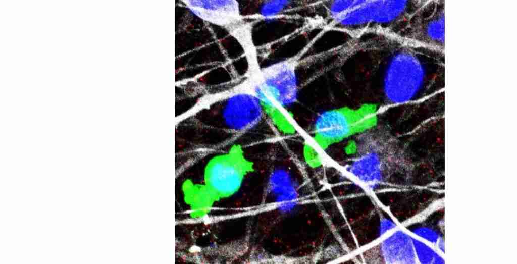 Japanese Researchers Link Compromised Synapse-Clearing Ability to Autism