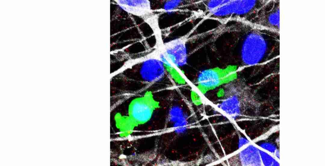 Japanese Researchers Link Compromised Synapse-Clearing Ability to Autism